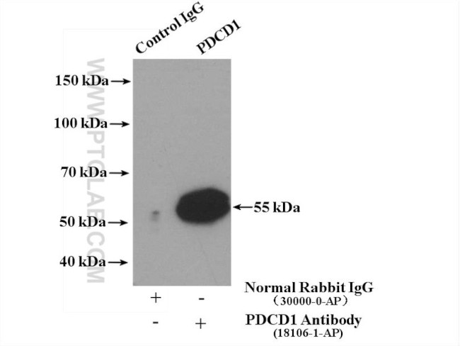 PD-1/CD279 Antibody in Immunoprecipitation (IP)