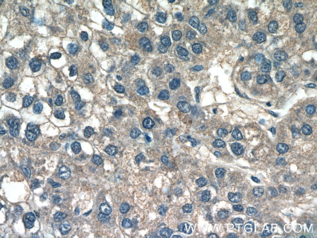 CXCL17 Antibody in Immunohistochemistry (Paraffin) (IHC (P))