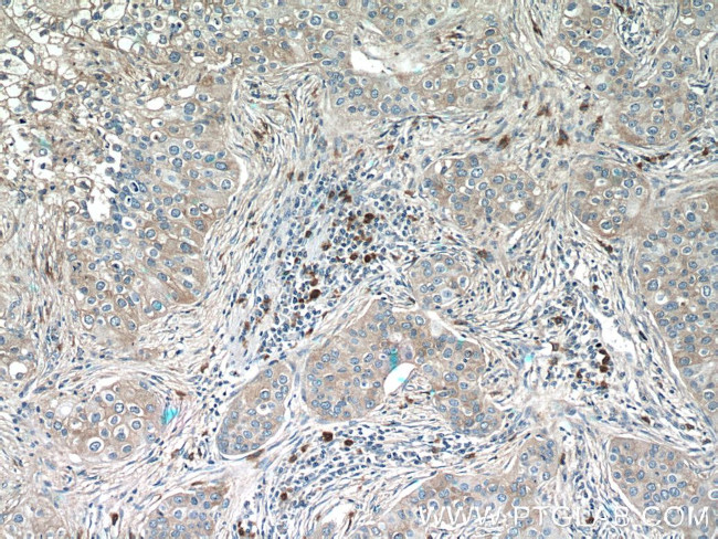 CXCL17 Antibody in Immunohistochemistry (Paraffin) (IHC (P))