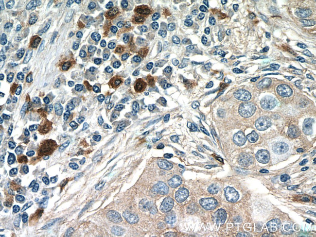 CXCL17 Antibody in Immunohistochemistry (Paraffin) (IHC (P))