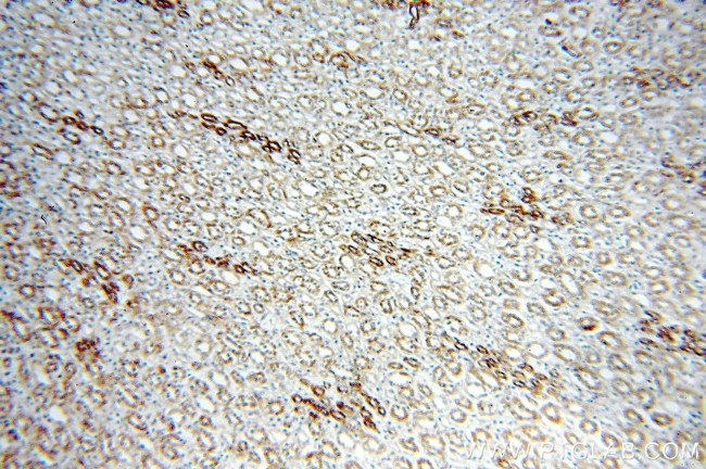 KLHL20 Antibody in Immunohistochemistry (Paraffin) (IHC (P))