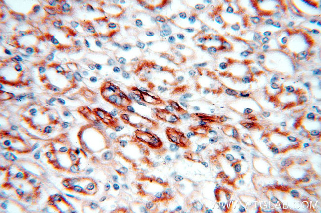 KLHL20 Antibody in Immunohistochemistry (Paraffin) (IHC (P))