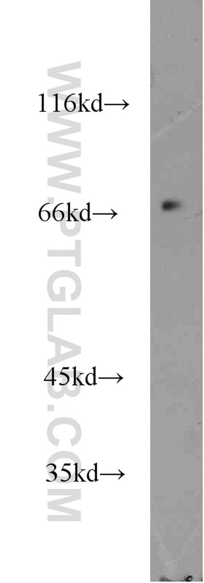 KLHL20 Antibody in Western Blot (WB)