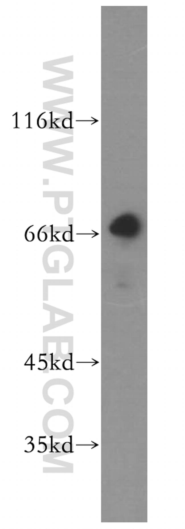 KLHL20 Antibody in Western Blot (WB)