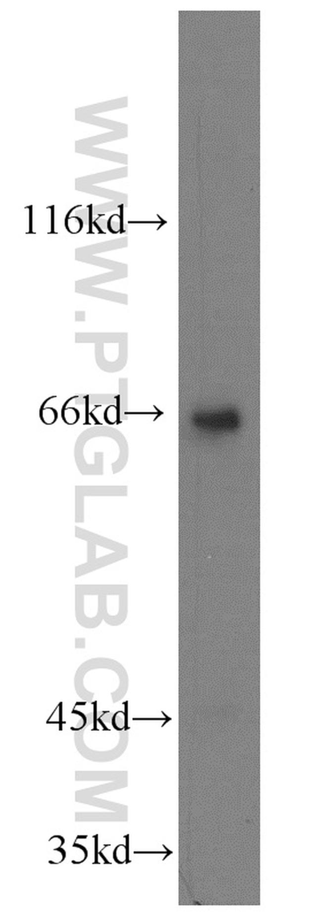 KLHL20 Antibody in Western Blot (WB)