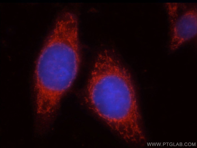 Uroguanylin Antibody in Immunocytochemistry (ICC/IF)