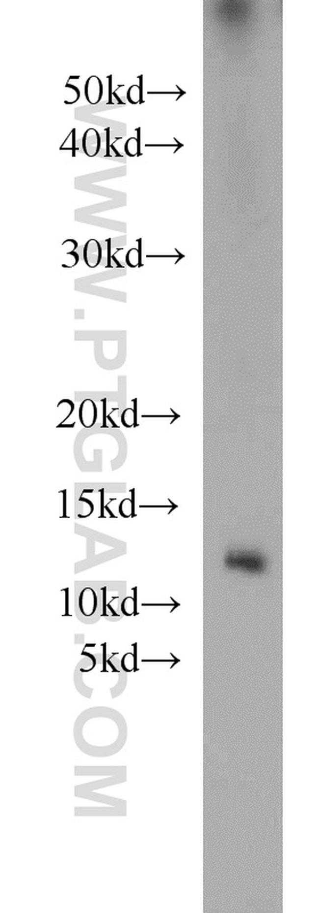 Uroguanylin Antibody in Western Blot (WB)