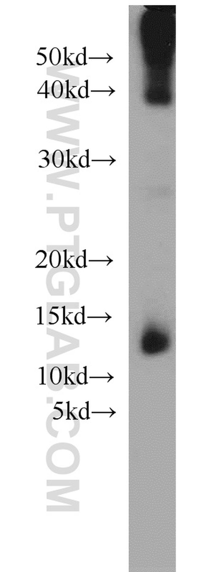 Uroguanylin Antibody in Western Blot (WB)