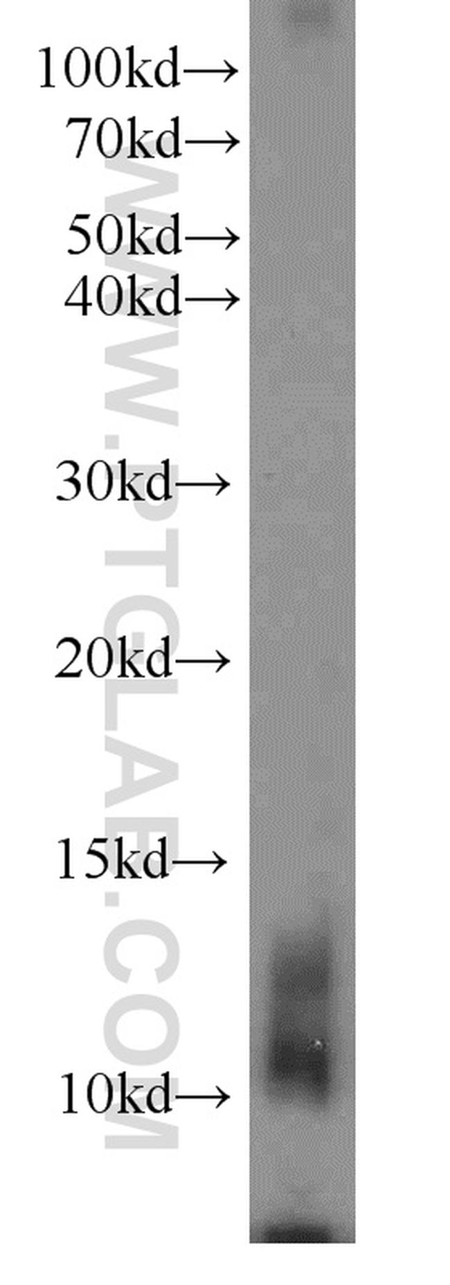 Uroguanylin Antibody in Western Blot (WB)