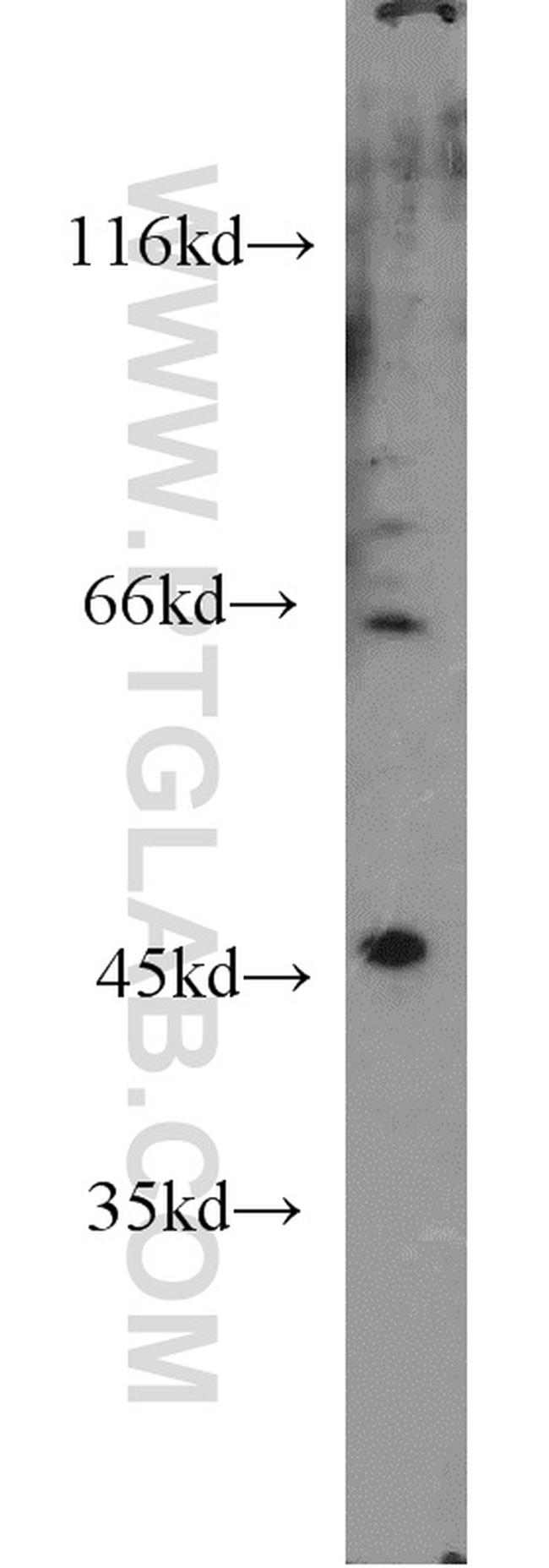 Synaptotagmin-13 Antibody in Western Blot (WB)