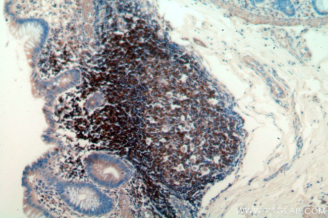 GCNT2 Antibody in Immunohistochemistry (Paraffin) (IHC (P))