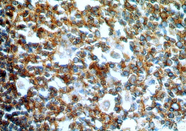 GCNT2 Antibody in Immunohistochemistry (Paraffin) (IHC (P))