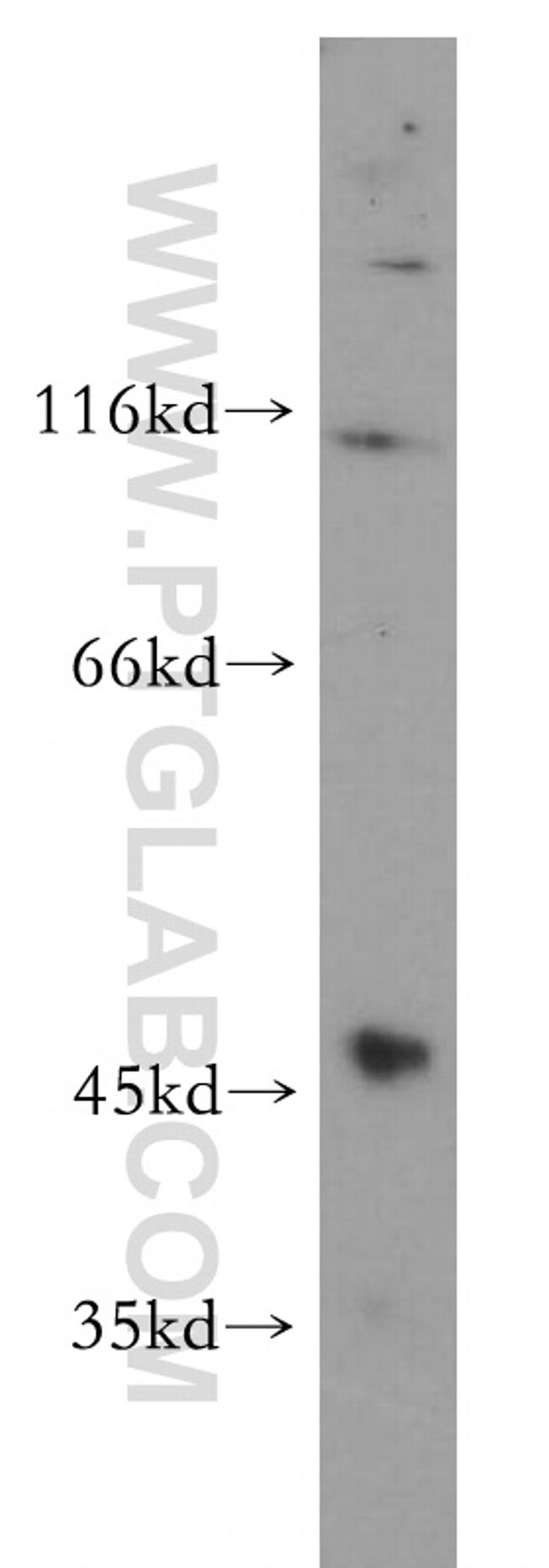 GCNT2 Antibody in Western Blot (WB)