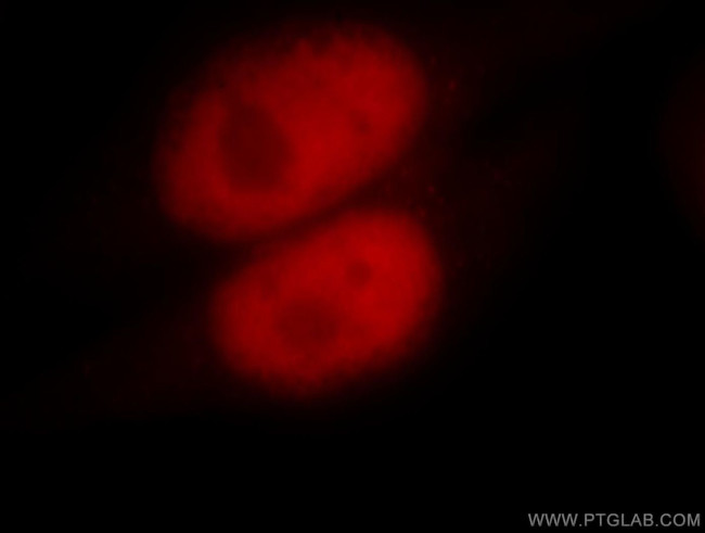 MSH6 Antibody in Immunocytochemistry (ICC/IF)