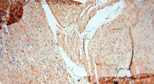 MSH6 Antibody in Immunohistochemistry (Paraffin) (IHC (P))