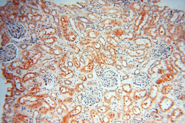 MSH6 Antibody in Immunohistochemistry (Paraffin) (IHC (P))