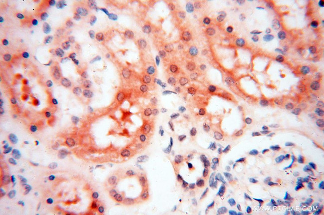 MSH6 Antibody in Immunohistochemistry (Paraffin) (IHC (P))