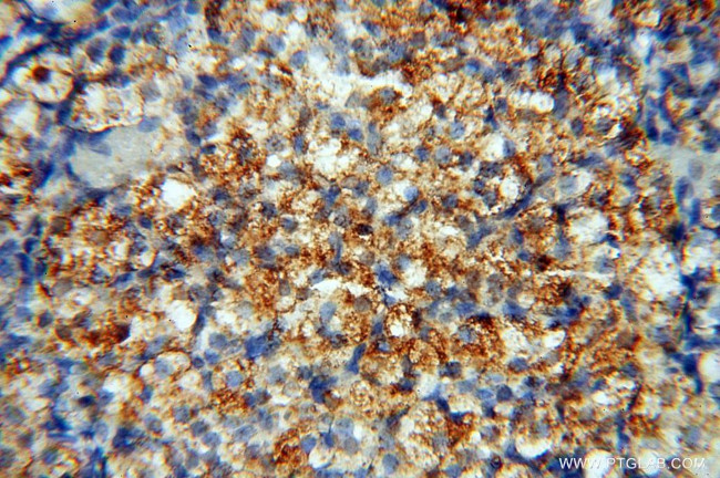 MSH6 Antibody in Immunohistochemistry (Paraffin) (IHC (P))