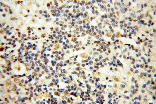 MSH6 Antibody in Immunohistochemistry (Paraffin) (IHC (P))