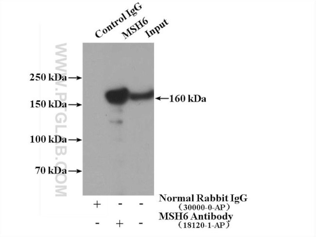 MSH6 Antibody in Immunoprecipitation (IP)