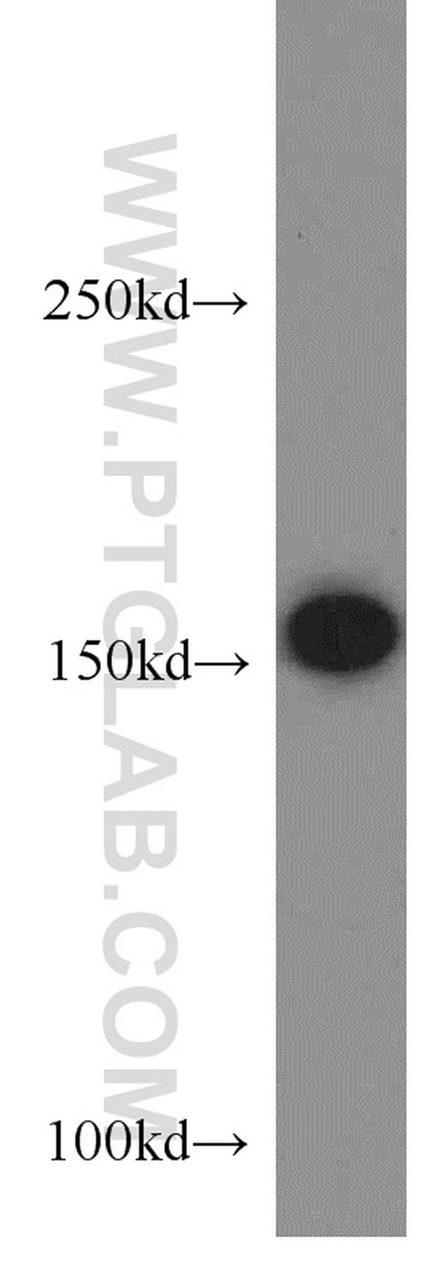 MSH6 Antibody in Western Blot (WB)