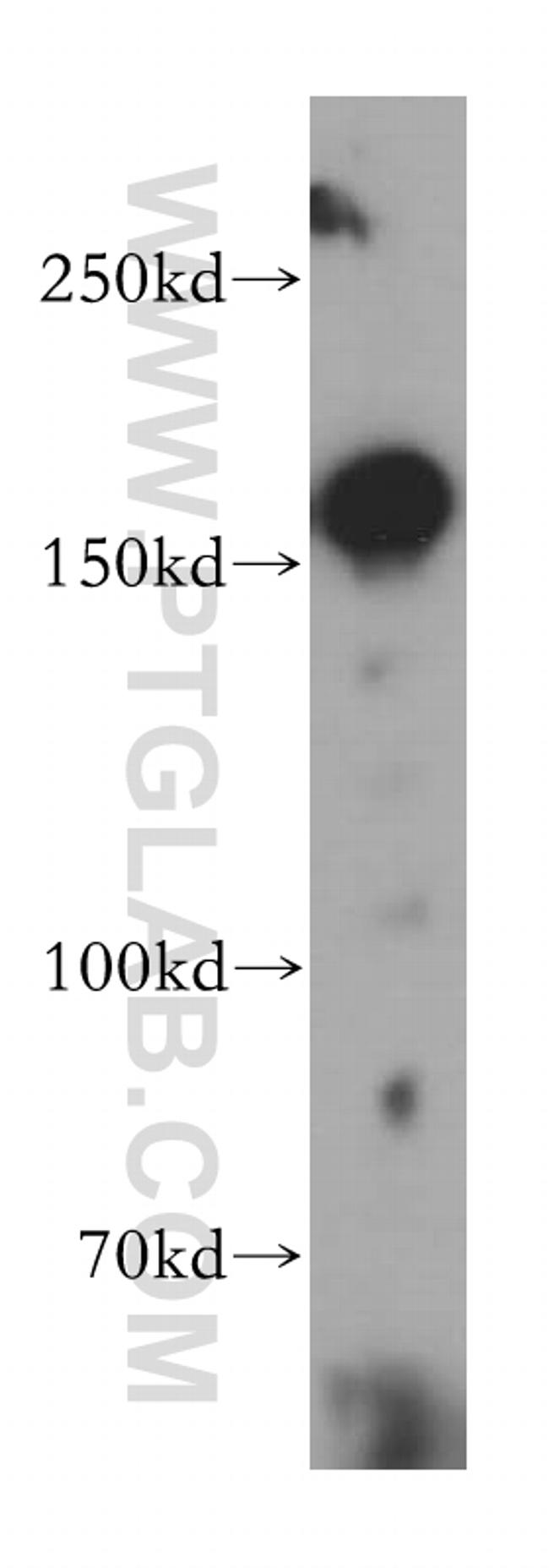 MSH6 Antibody in Western Blot (WB)