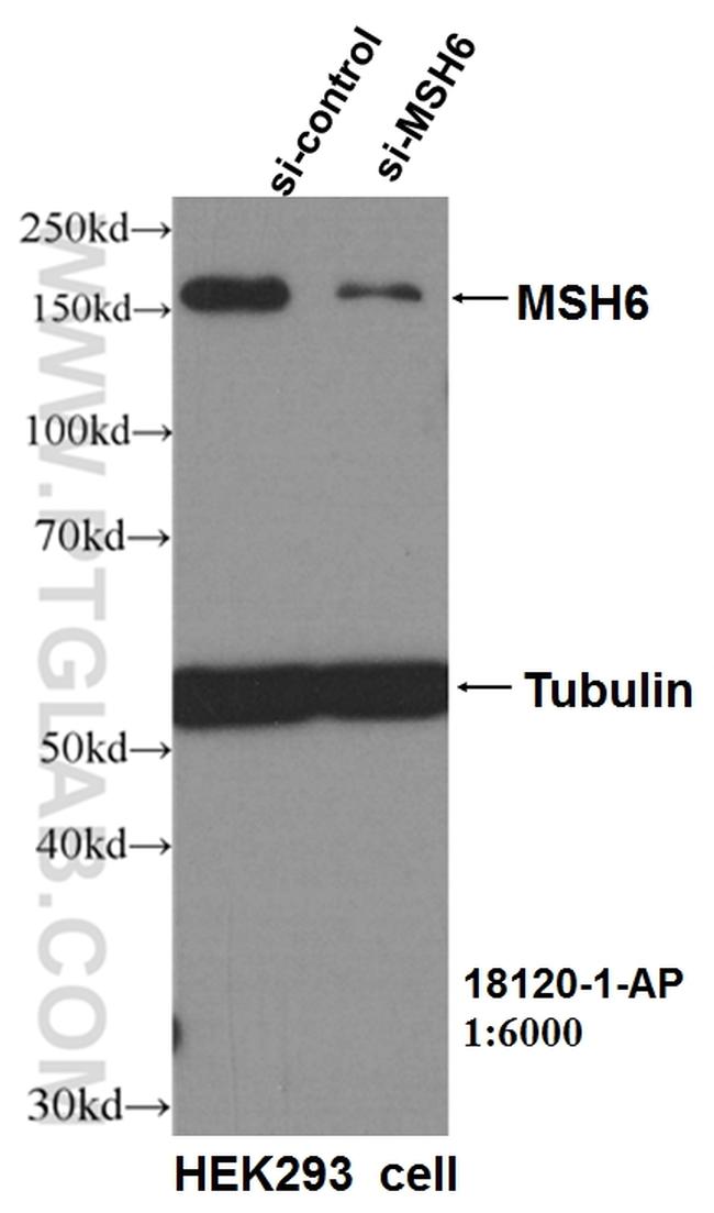 MSH6 Antibody in Western Blot (WB)