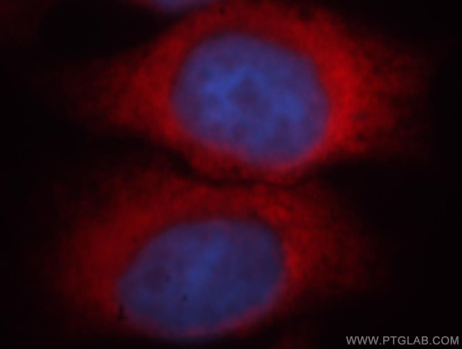 FARSA Antibody in Immunocytochemistry (ICC/IF)