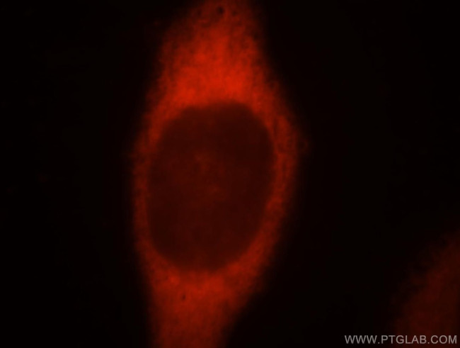 FARSA Antibody in Immunocytochemistry (ICC/IF)