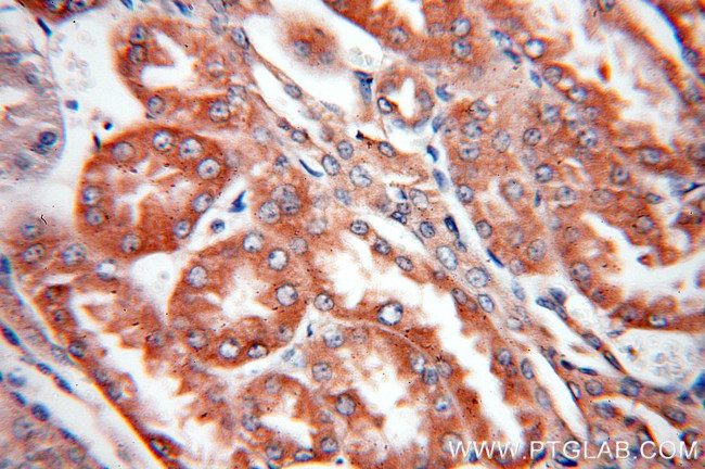 FARSA Antibody in Immunohistochemistry (Paraffin) (IHC (P))