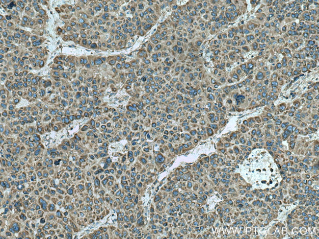 FARSA Antibody in Immunohistochemistry (Paraffin) (IHC (P))