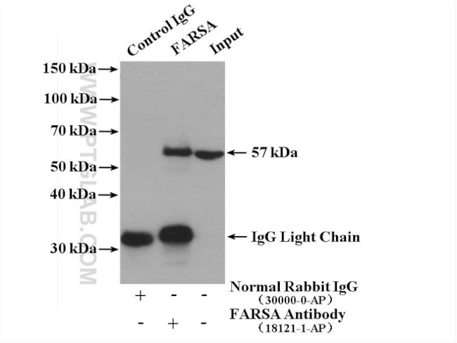 FARSA Antibody in Immunoprecipitation (IP)