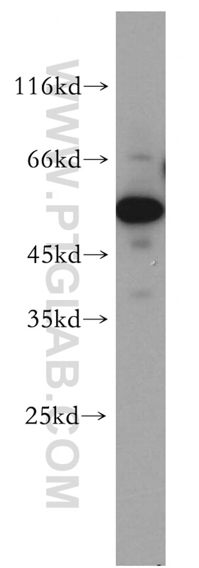 FARSA Antibody in Western Blot (WB)