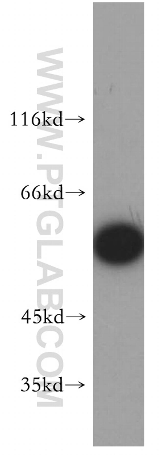 FARSA Antibody in Western Blot (WB)