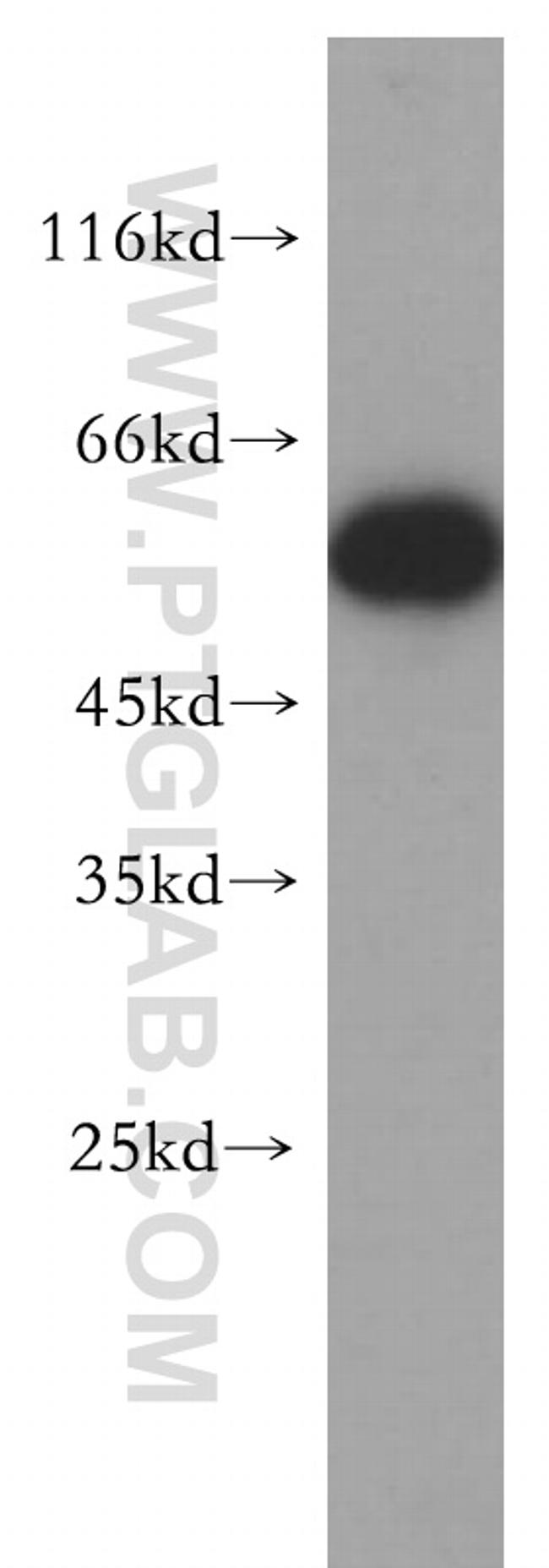 FARSA Antibody in Western Blot (WB)