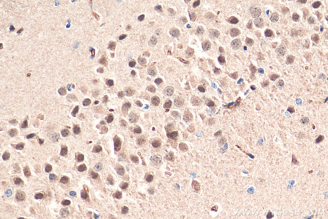 LC8/DYNLL1 Antibody in Immunohistochemistry (Paraffin) (IHC (P))