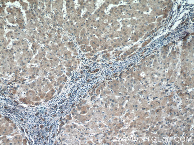 LYN Antibody in Immunohistochemistry (Paraffin) (IHC (P))