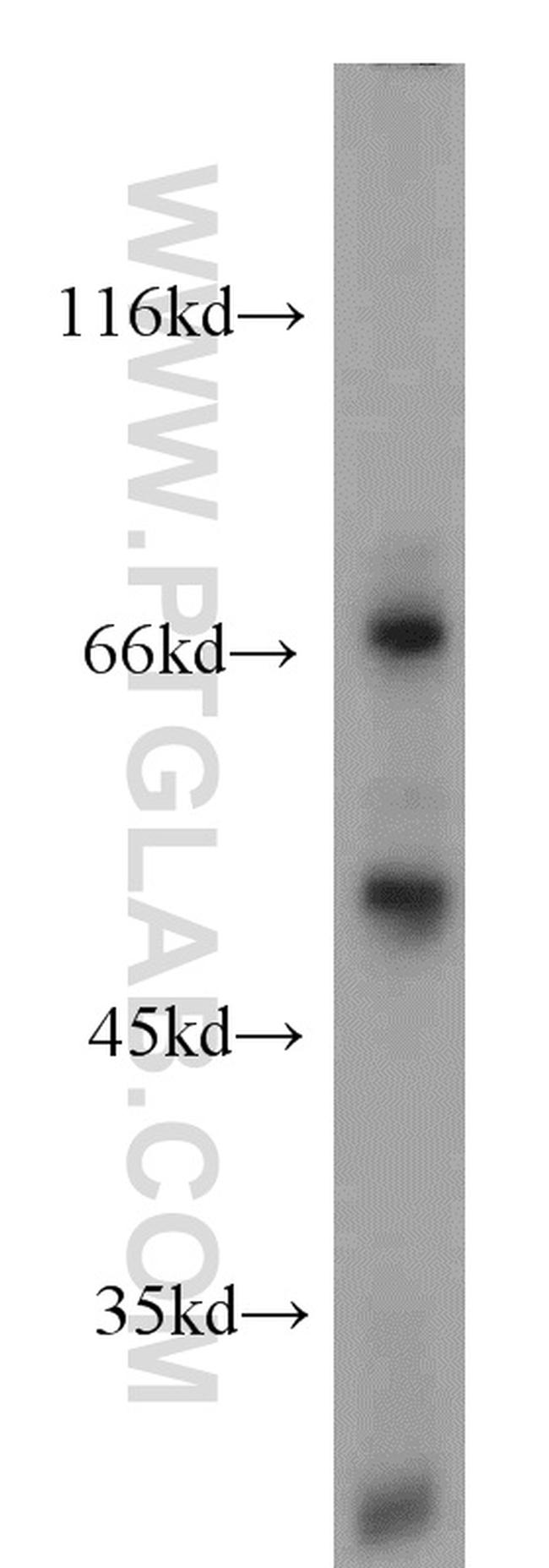 LYN Antibody in Western Blot (WB)