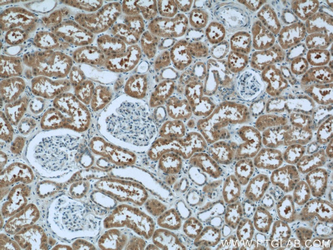 LYN Antibody in Immunohistochemistry (Paraffin) (IHC (P))