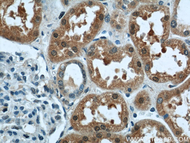 LYN Antibody in Immunohistochemistry (Paraffin) (IHC (P))