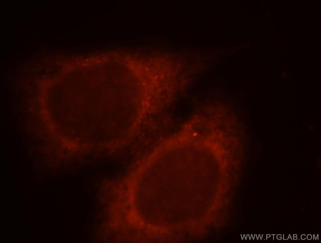 RAB11FIP2 Antibody in Immunocytochemistry (ICC/IF)