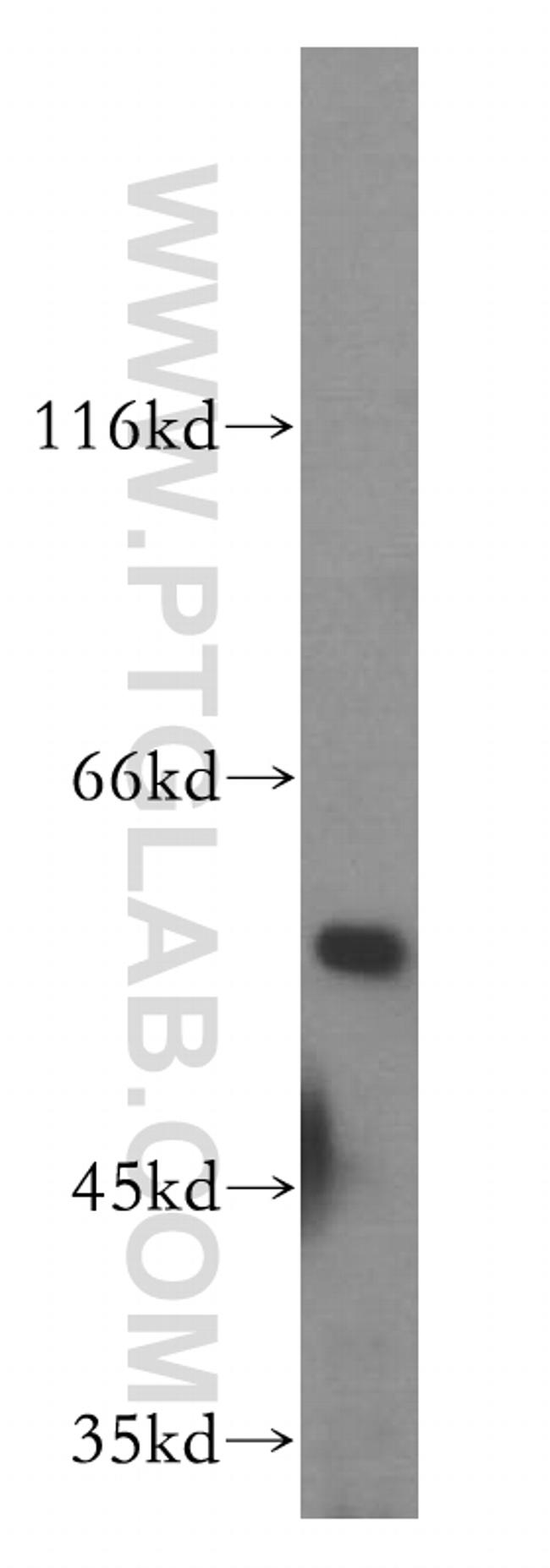 RAB11FIP2 Antibody in Western Blot (WB)