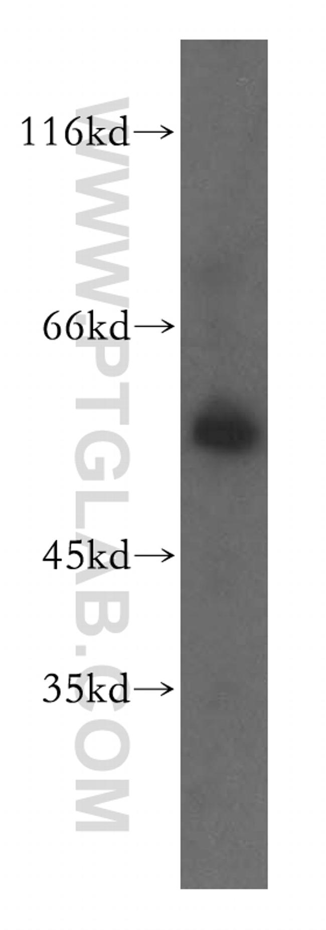 RAB11FIP2 Antibody in Western Blot (WB)