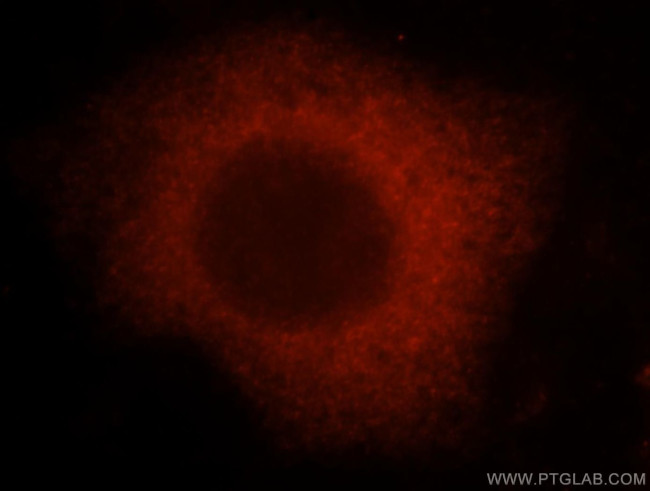 importin alpha 5 Antibody in Immunocytochemistry (ICC/IF)