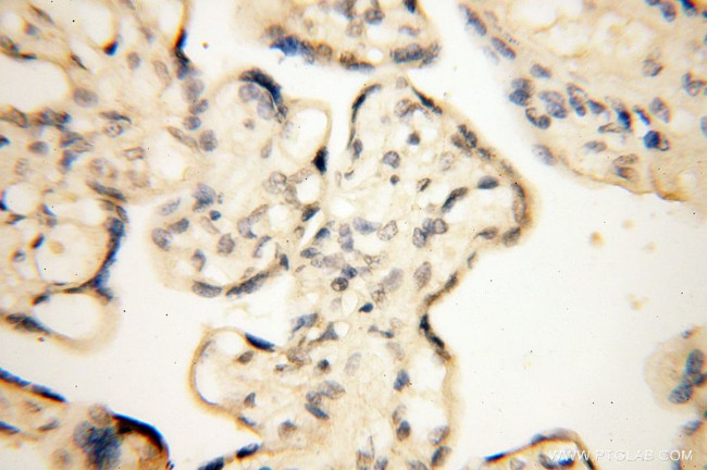 importin alpha 5 Antibody in Immunohistochemistry (Paraffin) (IHC (P))