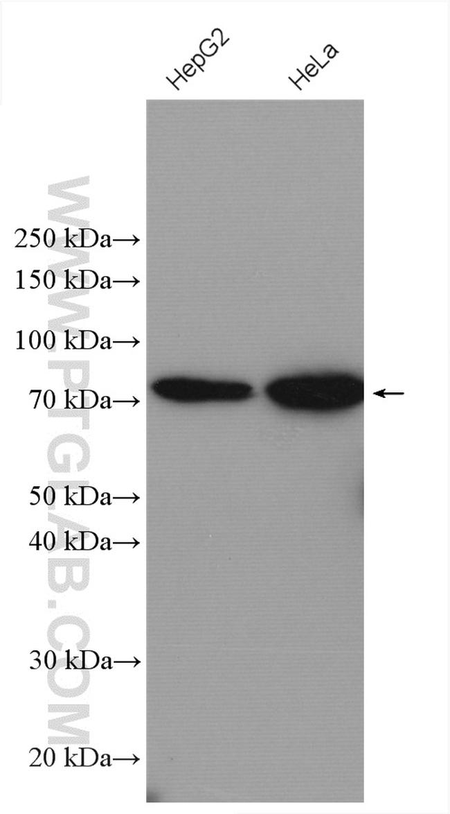 ABCD1 Antibody in Western Blot (WB)