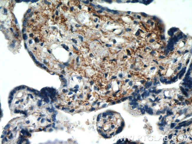 HYAL4 Antibody in Immunohistochemistry (Paraffin) (IHC (P))