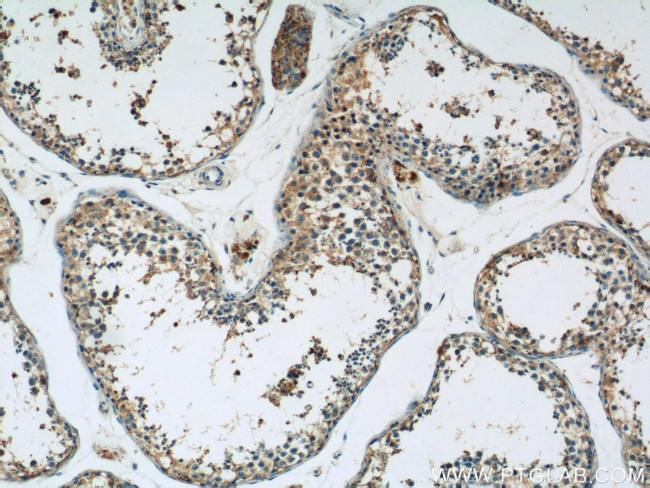 HYAL4 Antibody in Immunohistochemistry (Paraffin) (IHC (P))