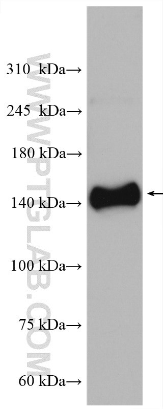 HRC Antibody in Western Blot (WB)