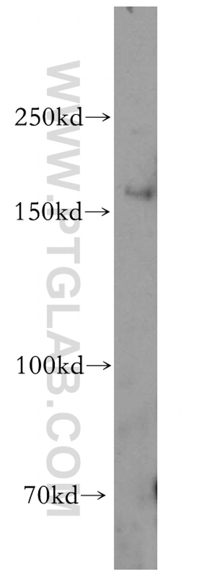 HRC Antibody in Western Blot (WB)